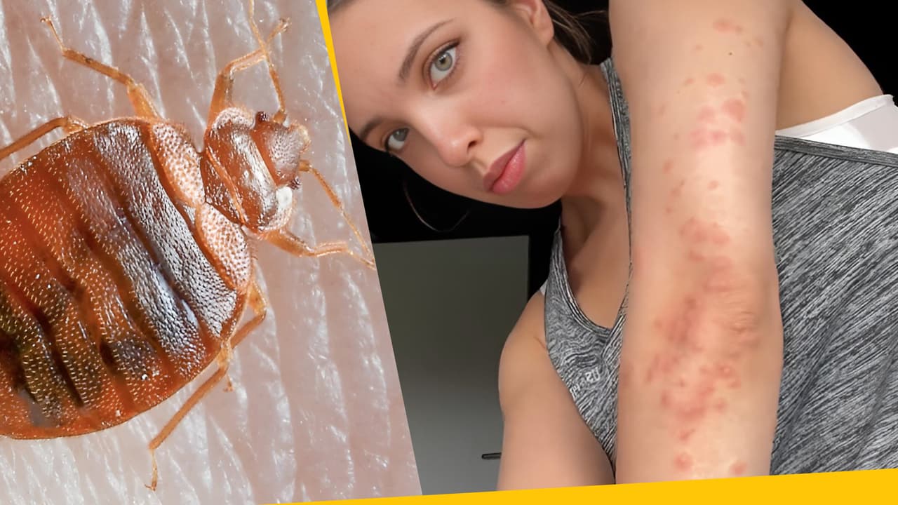 ¿Qué tan peligrosas son las chinches en realidad? Te decimos cómo evitarlas