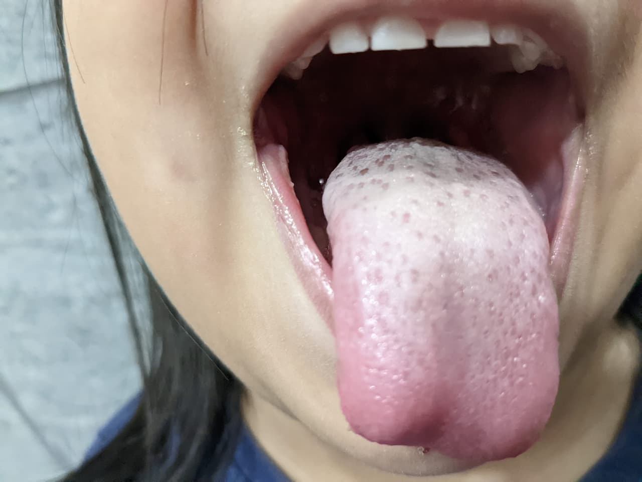 Tres niñas hospitalizadas por deshidratación en escuela de Stockton, California