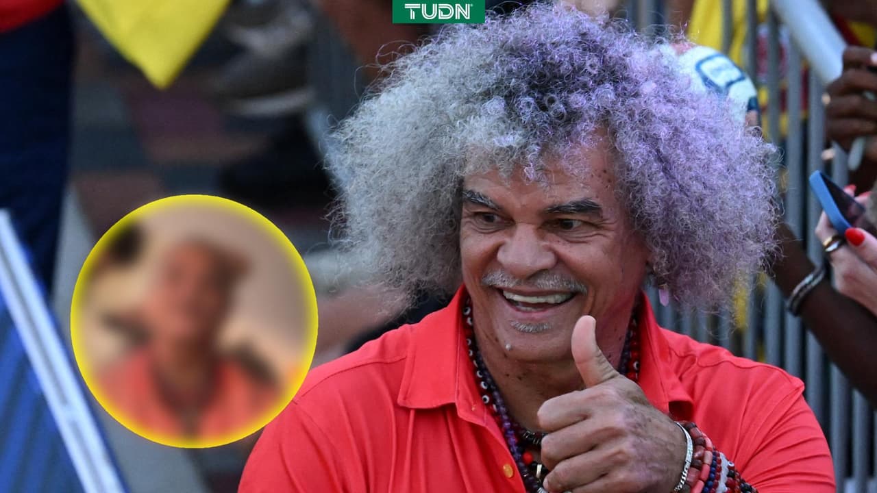 El Pibe Valderrama pierde la cabellera
