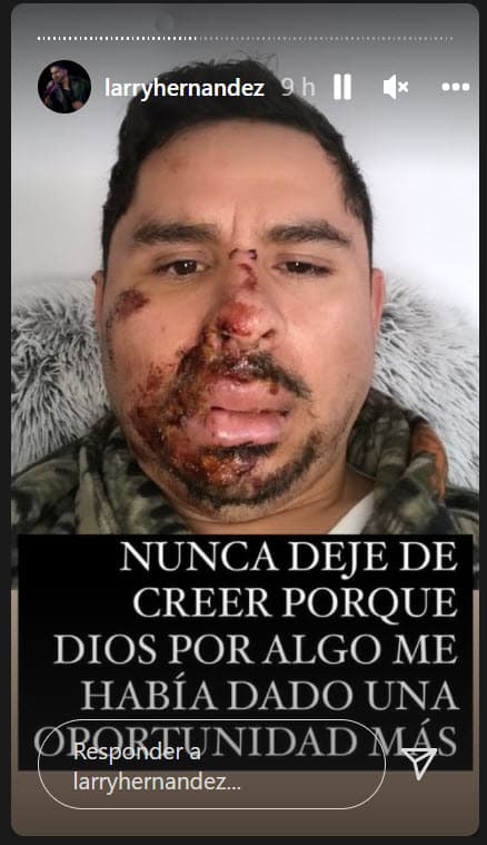 Tuvieron que pasar varios meses para que lo volviera a hacer después de terapias y rehabilitación. Por eso, valora que pueda seguir su carrera con nuevo material. 
<br>