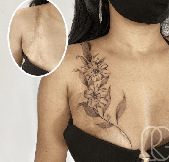 A algunas personas las cicatrices las hacen sentir inseguras, tanto así que prefieren esconderlas. Gracias a la tecnología y a los 
<a href="https://www.univision.com/estilo-de-vida/belleza/tatuajes-que-parecen-bordados-para-las-mujeres-llenas-de-alegria-y-muy-originales">tatuajes</a>, las marcas de la piel ya se pueden convertir en arte.