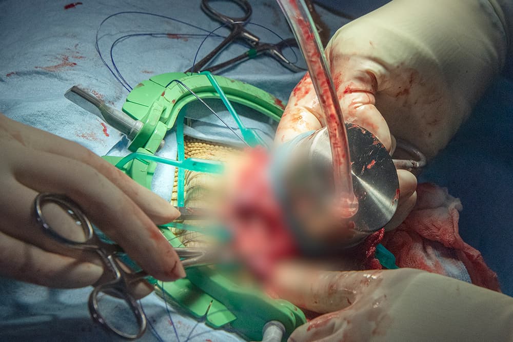 Poco a poco y con mucho cuidado lo fueron retirando.