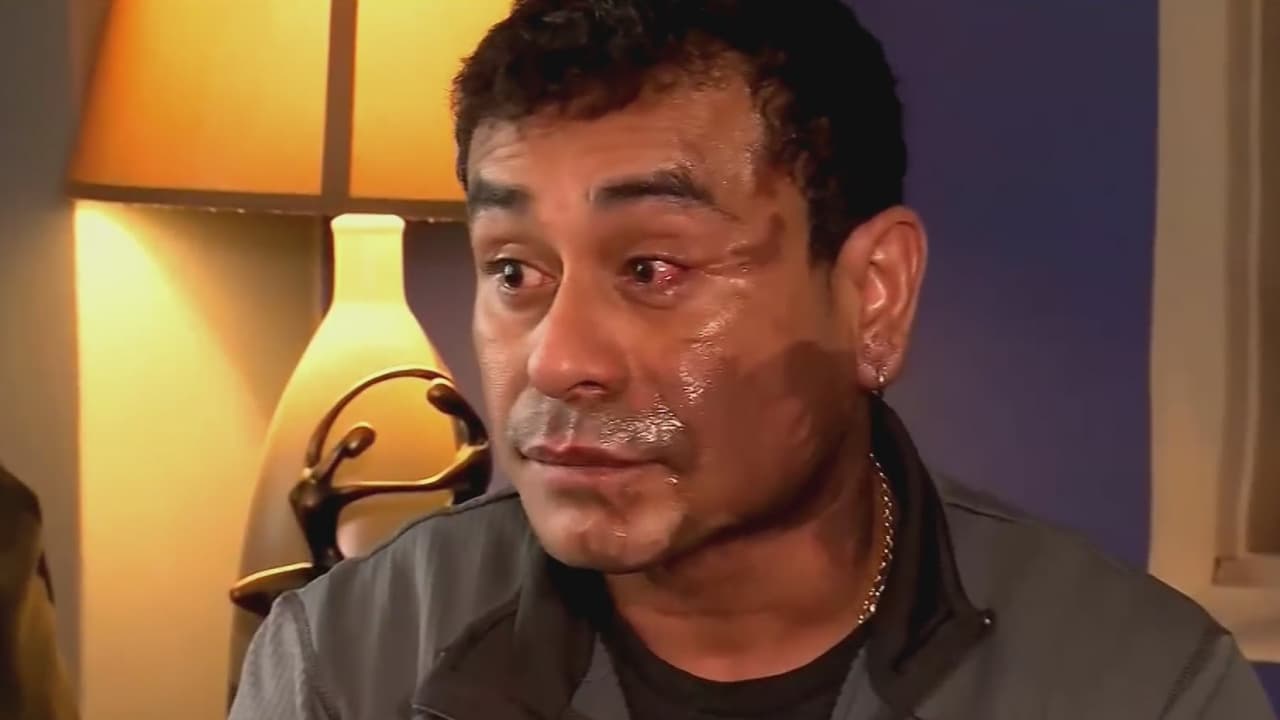 "Tiene la cara pelada y no podrá trabajar": el inmigrante peruano al que atacaron con ácido y terminó con quemaduras de segundo grado