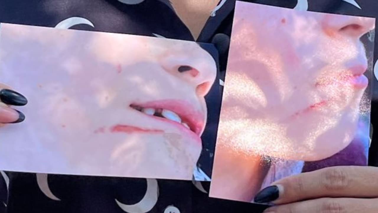 Fotos que Paola le tomó a su hijo tras bajar del autobús donde presuntamente lo agredieron físicamente.