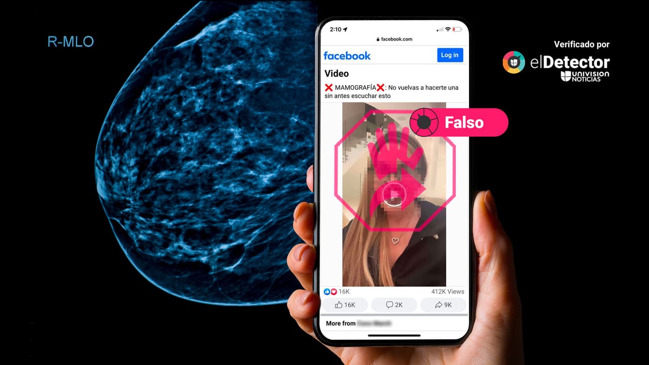 Es falso que las mamografías no son seguras y que sus beneficios no superan los riesgos 