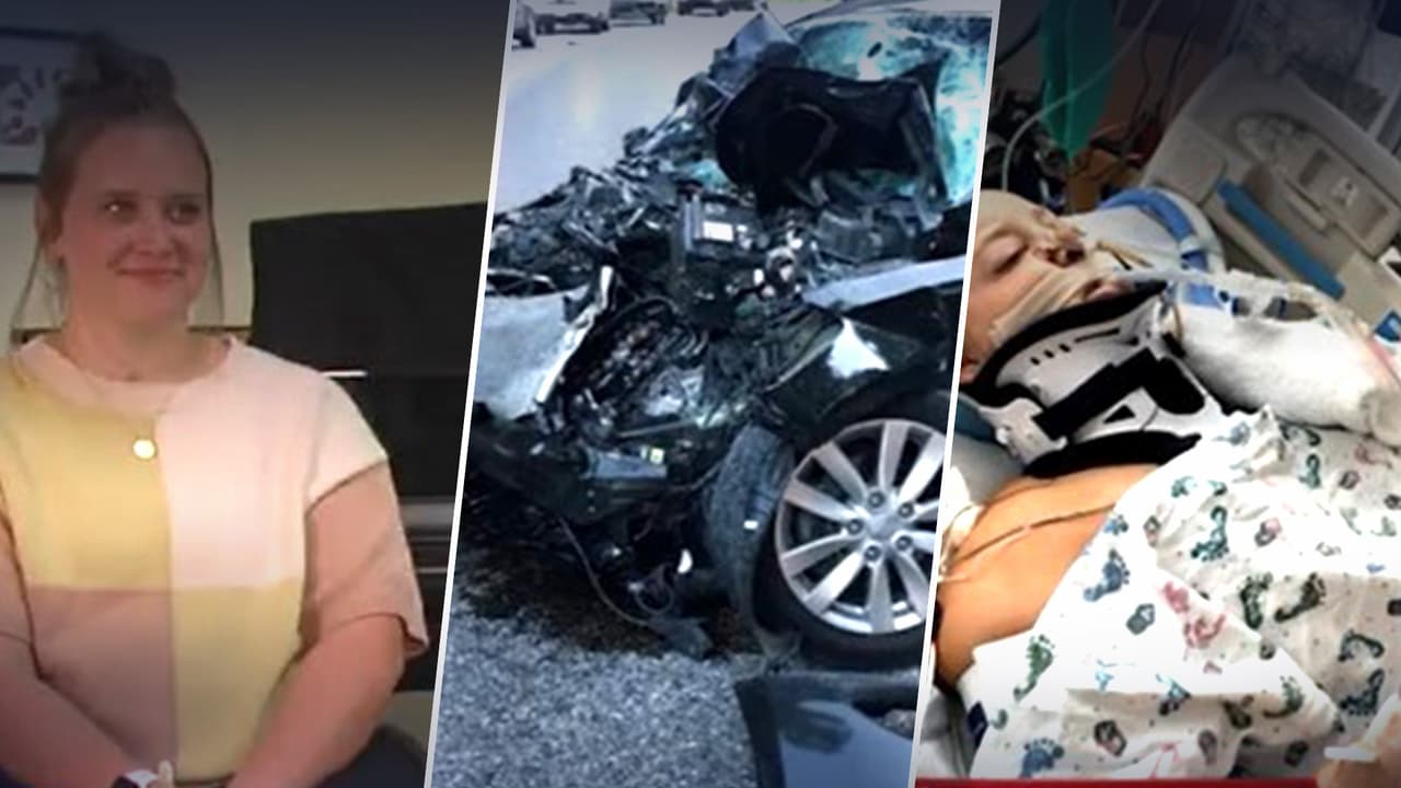 "Tuve que empezar de cero”: Pierde las piernas en accidente de tránsito y se convierte en fuente de inspiración