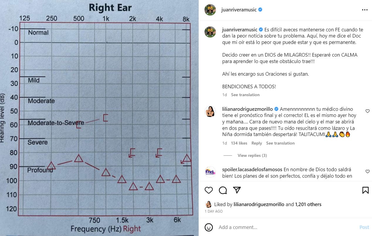 Juan Rivera ha perdido audición y su padecimiento es permanente.