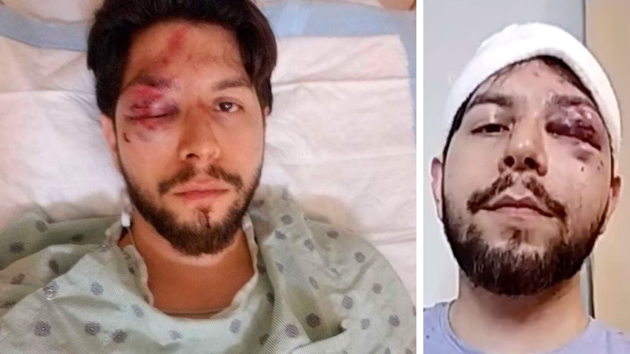 “Casi me matan”, hispano recibe paliza en pleno centro de Chicago por un grupo de adolescentes