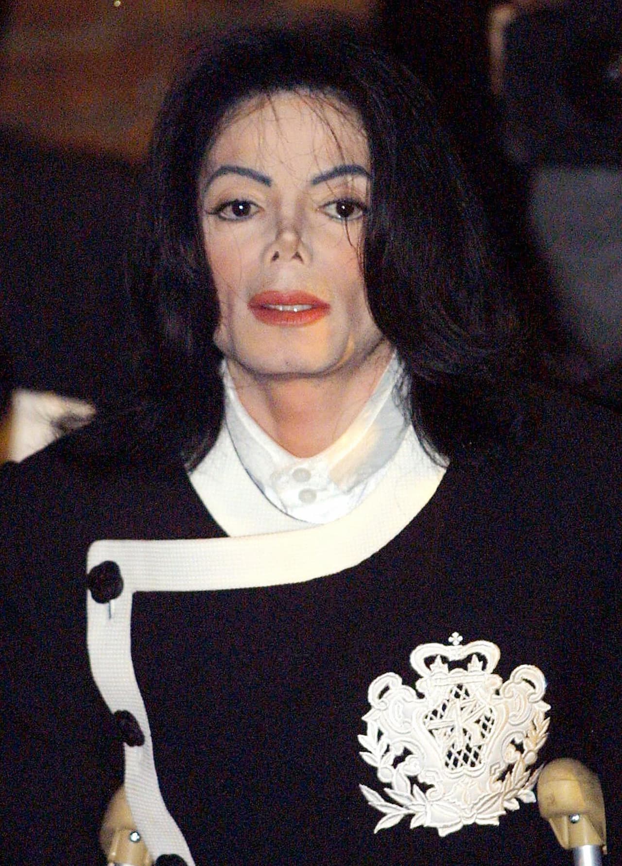 Michael Jackson sufría de vitíligo, por lo que decidió someterse a un Skin bleaching.