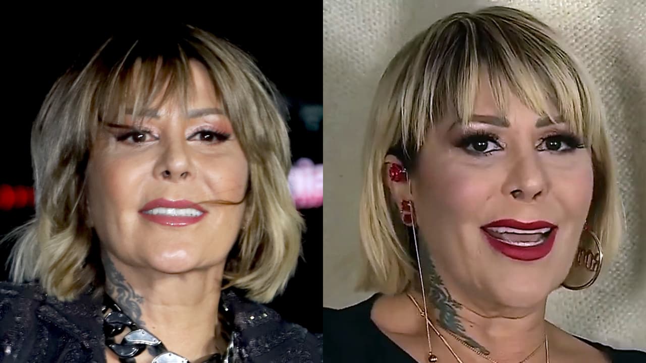 Alejandra Guzmán reaparece tras cirugía de emergencia: comparte foto de cómo quedó tras operación