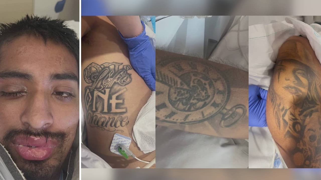 ¿Lo conoces? Banner Health está buscando a la familia de un hombre hispano que fue atropellado