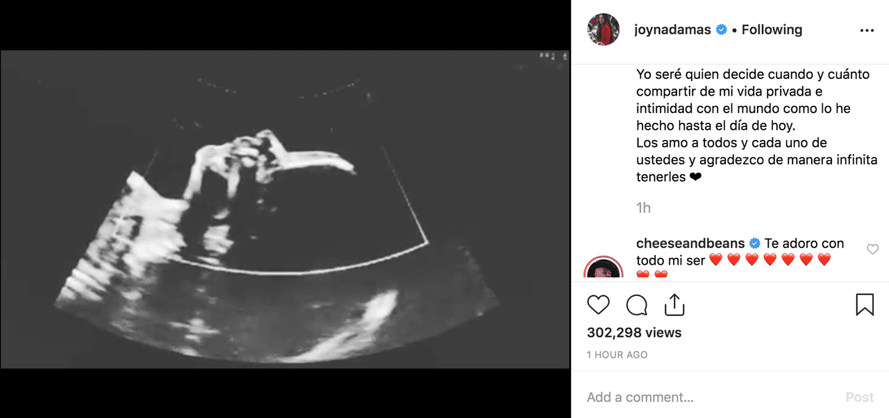 "Los amo a todos y cada uno de ustedes y agradezco de manera infinita tenerles", concluyó Joy, recibiendo de inmediato el mensaje de
<b>su hermano y colega Jesse Huerta</b>: "Te adoro con todo mi ser".