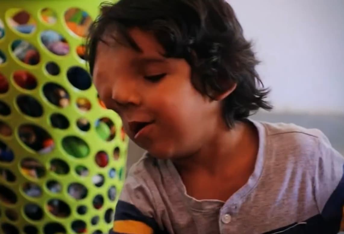 "Nos ha tocado escuchar niños que lloran y dicen:
<b> 'mamá es un monstruo; yo no quiero jugar con él'"</b>, cuenta Michelle Núñez de Thielen, madre del pequeño, quien anhela con toda su alma una mejor calidad de vida para el niño. 
<br>