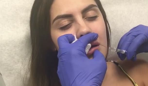 Alexa fue muy criticada en el pasado cuando publicó un video invitando a sus fanáticos a inyectarse productos cosméticos.