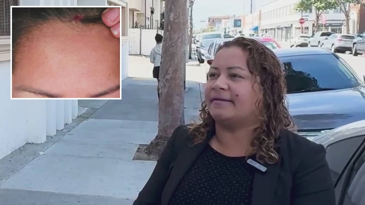 Salvadoreña denuncia abuso policíaco en medio de una infracción de tránsito en Huntington Park