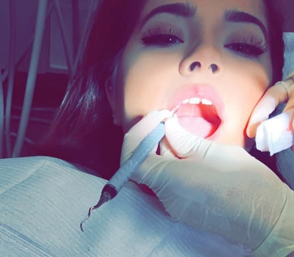 La cantante compartió su visita al dentista, quien se encargó de hacer todo para que su sonrisa luciera radiente.