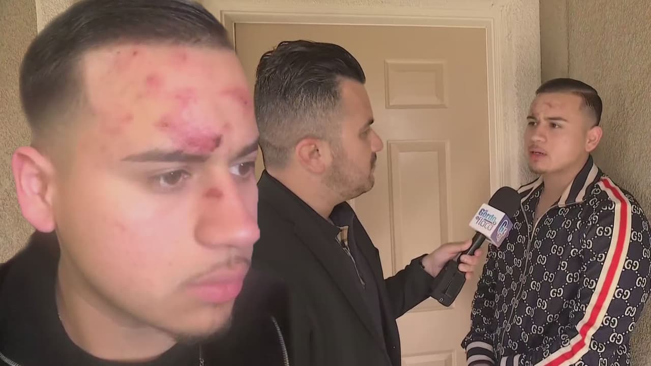 Vocalista de Fuerza Regida es arrestado y denuncia abuso de autoridad al ser supuestamente golpeado por policías