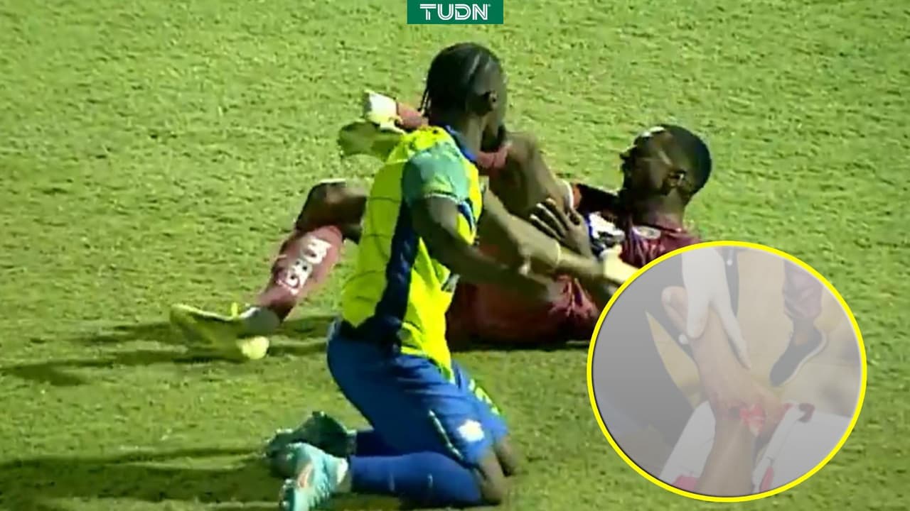 ¡Imágenes sensibles! Escalofriante lesión en el futbol de Honduras