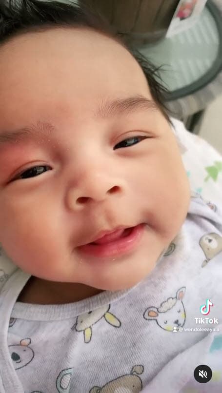 Aunque logró recuperarse de las infecciones, recientemente Wendolee compartió en el programa 'Ventaneando' que su hija, de 3 meses, está padeciendo las 
<b>secuelas de haber estado tanto tiempo intubada</b> y en la misma posición en cama.
<br>