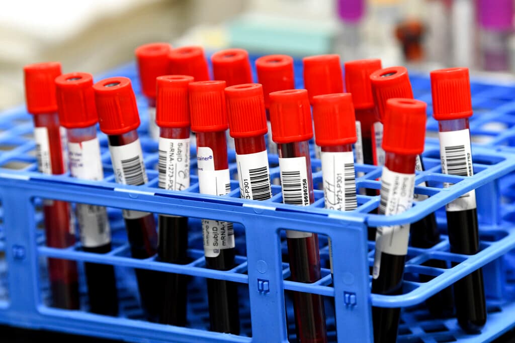 Nuevo repunte de coronavirus en California y el Área de la Bahía: variante FLiRT