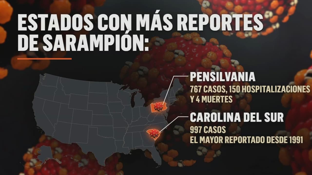 Sarampión enciende alertas en EEUU: ¿Por qué hay preocupaciones en California y a lo largo del país?