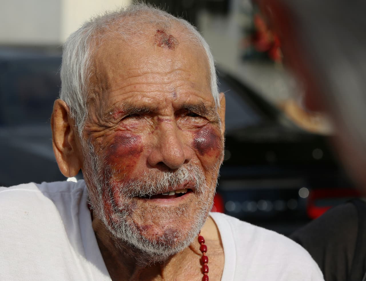 Esperamos que el abuelo Rodolfo viva muchos años y que estos asaltos de idio no se repitan más. Foto de archivo, Julio,11 de 2018. (AP Photo/Damian Dovarganes, File)
