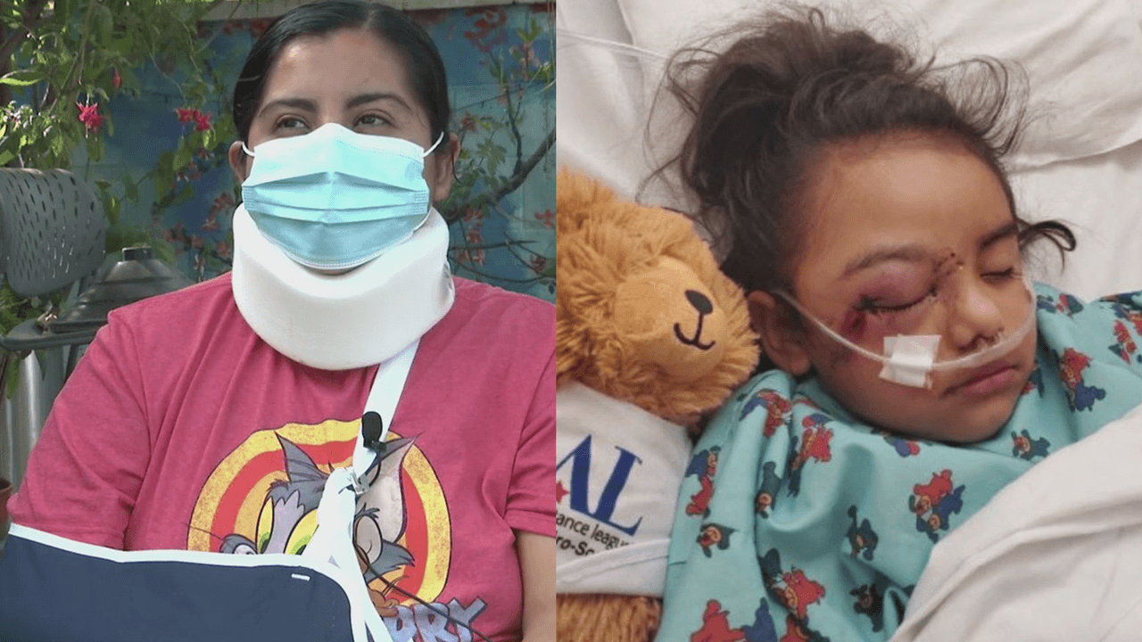 Esta familia vive una pesadilla tras resultar gravemente herida luego de que conductor los embistiera