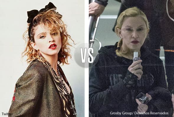 ¡¿Qué le ocurrió a Madonna?!