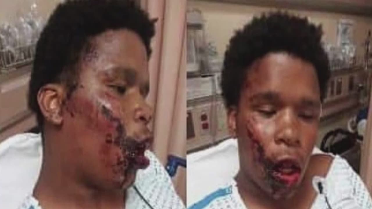 Denuncian que un joven fue golpeado por la policía durante una manifestación en El Bronx