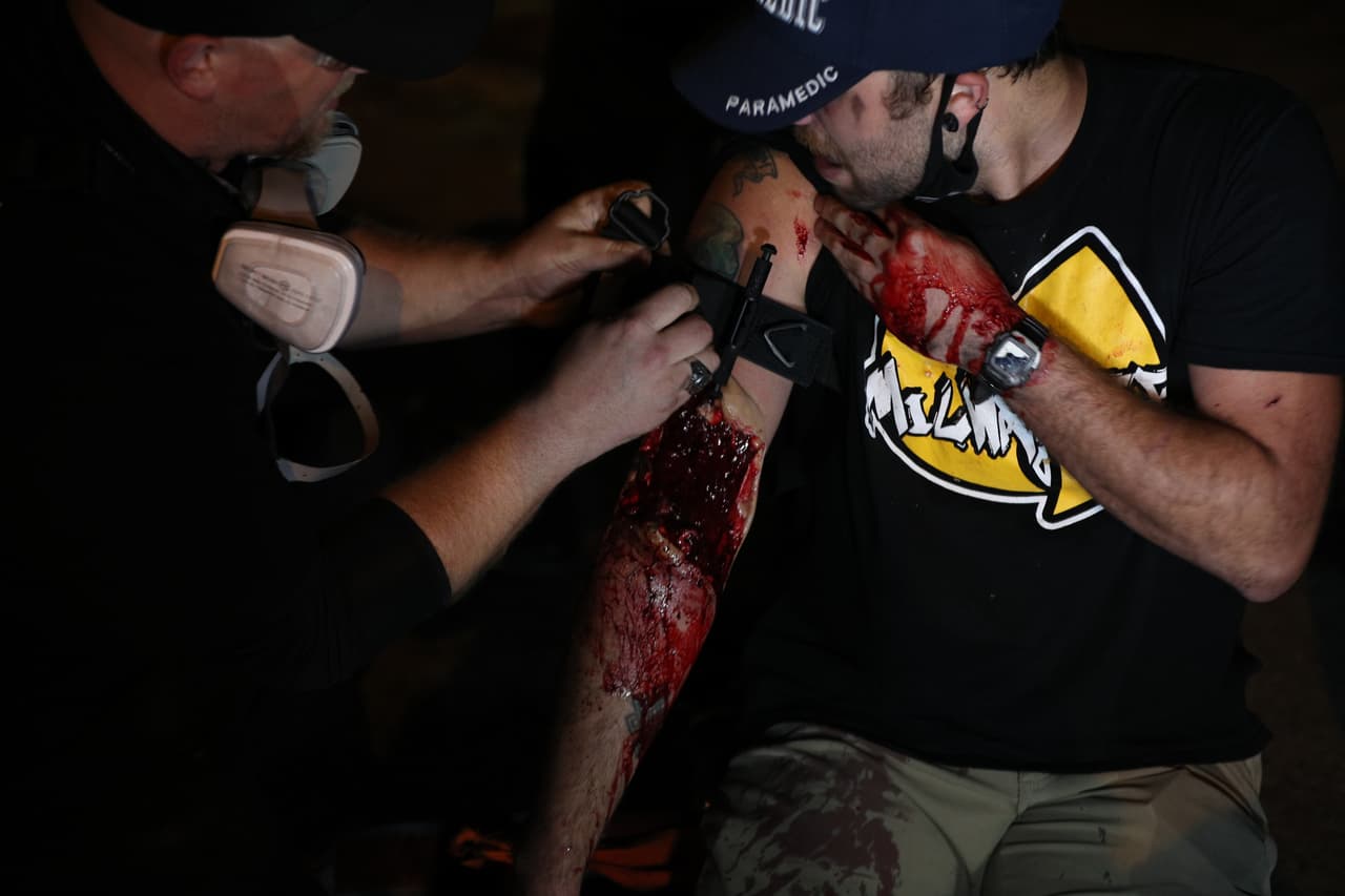 Beth dijo que no sabía en qué partes del cuerpo fue herida la tercera persona, pero que no se cree que las lesiones pongan en peligro su vida. En esta fotografía se ve al manifestante herido en el brazo. 
<br>