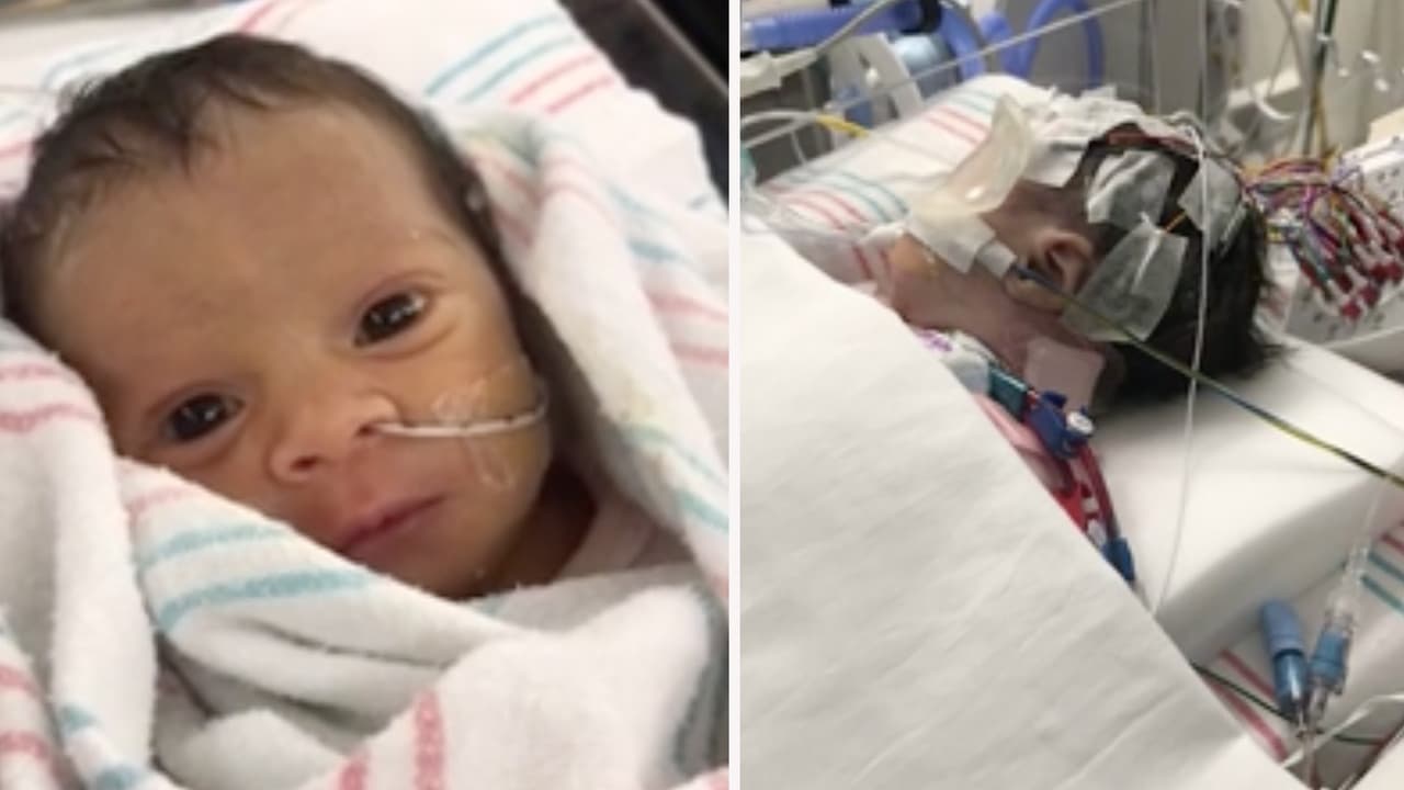 La pequeña Milagros fue sometida a una cirugía del corazón a los pocos días de nacida, la intervención fue todo un éxito pero según la familia, se le administró un medicamento con alto contenido de sodio que le provocó un colapso en los riñones y ha ido degenerando su salud.