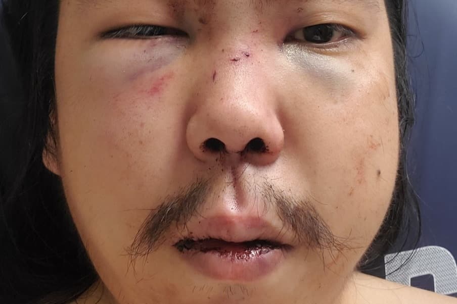 Así quedó el joven de 30 años.