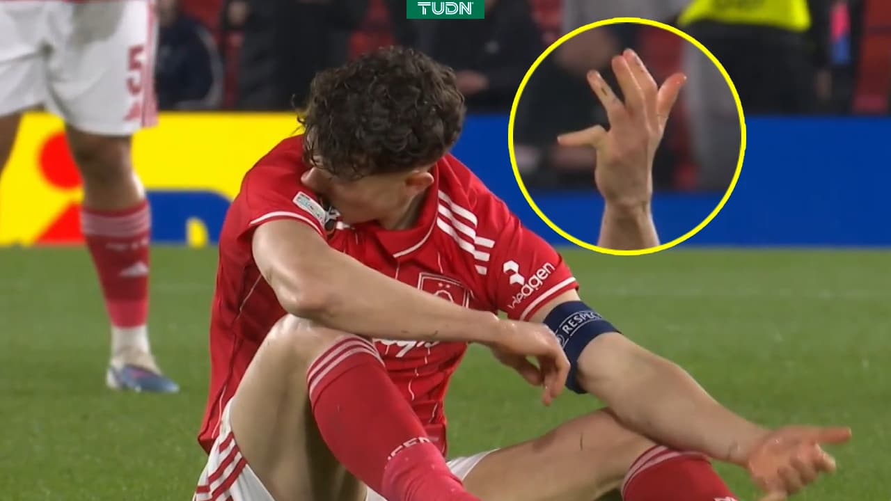 ¡Escalofriante! Jugador del Nottingham Fores se disloca el dedo vs. Fenerbahce