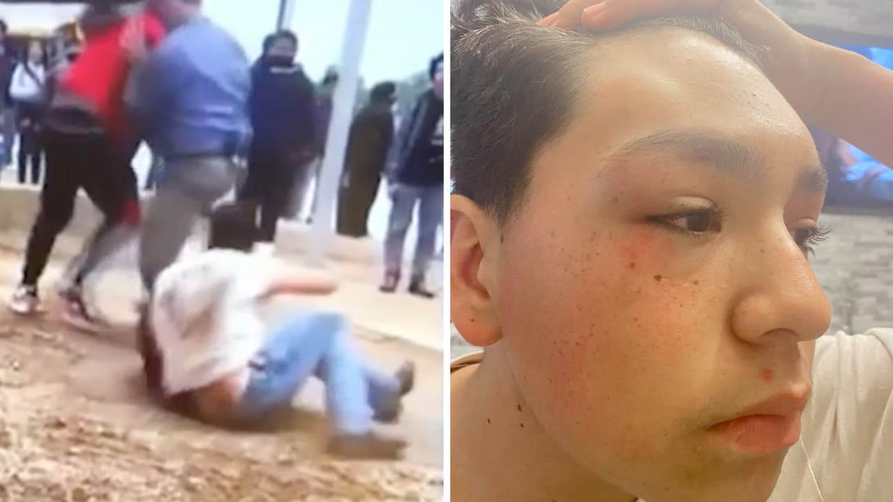 "No fue una pelea": Madre de alumno hispano denuncia golpiza a su hijo en escuela de Texas