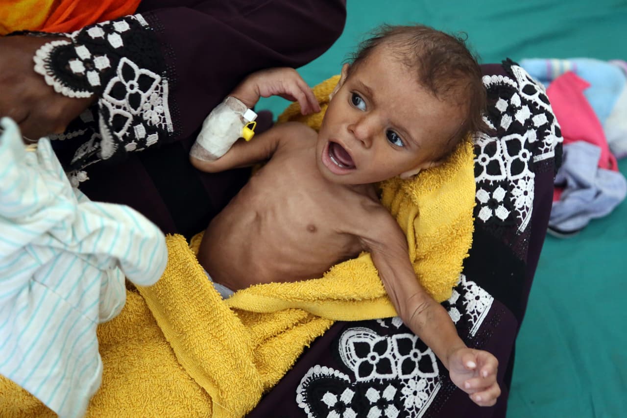 Una mujer yemení sostiene a un niño desnutrido en un hospital de Taez, en el sudoeste del país de Yemen, el 21 de noviembre de 2018. "Nos sentimos horrorizados de que unos 85,000 niños en Yemen puedan haber muerto como consecuencia del hambre extrema desde que comenzó la guerra”, continúa el comunicado de la ONG.