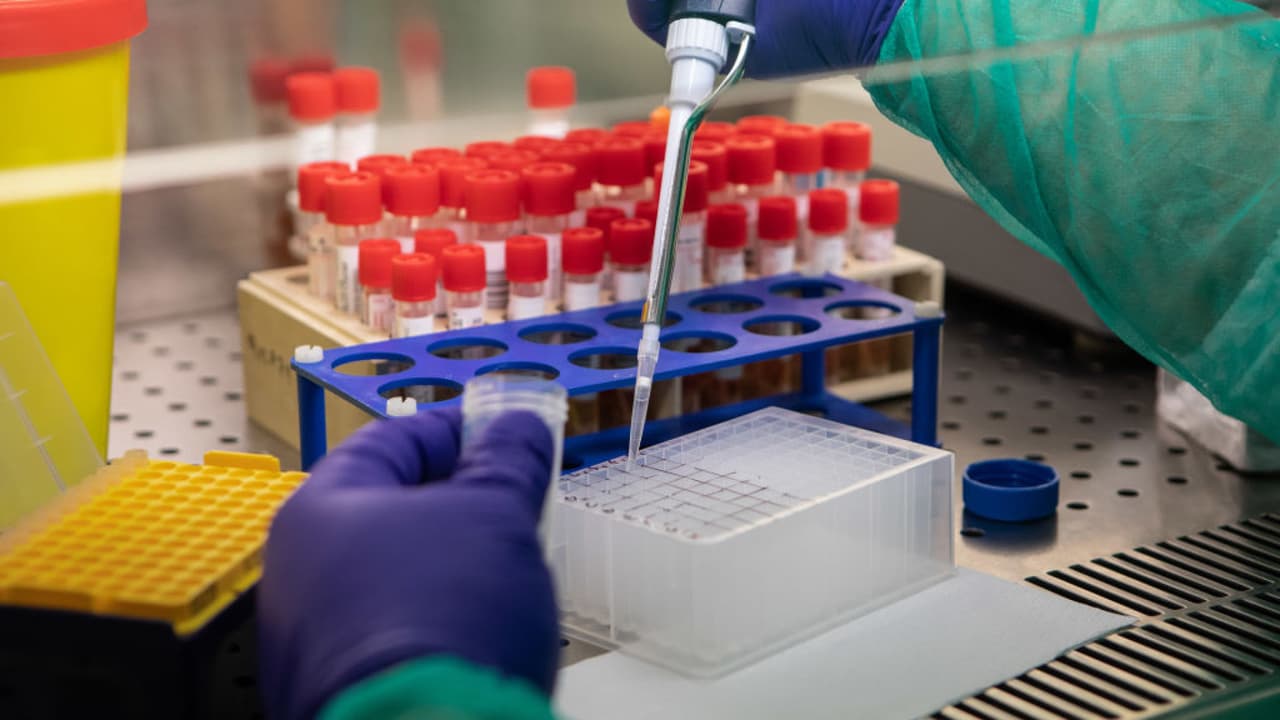 Covid-19: ¿Serías voluntario para los ensayos de la vacuna? ¿Te la pondrías cuando esté lista?