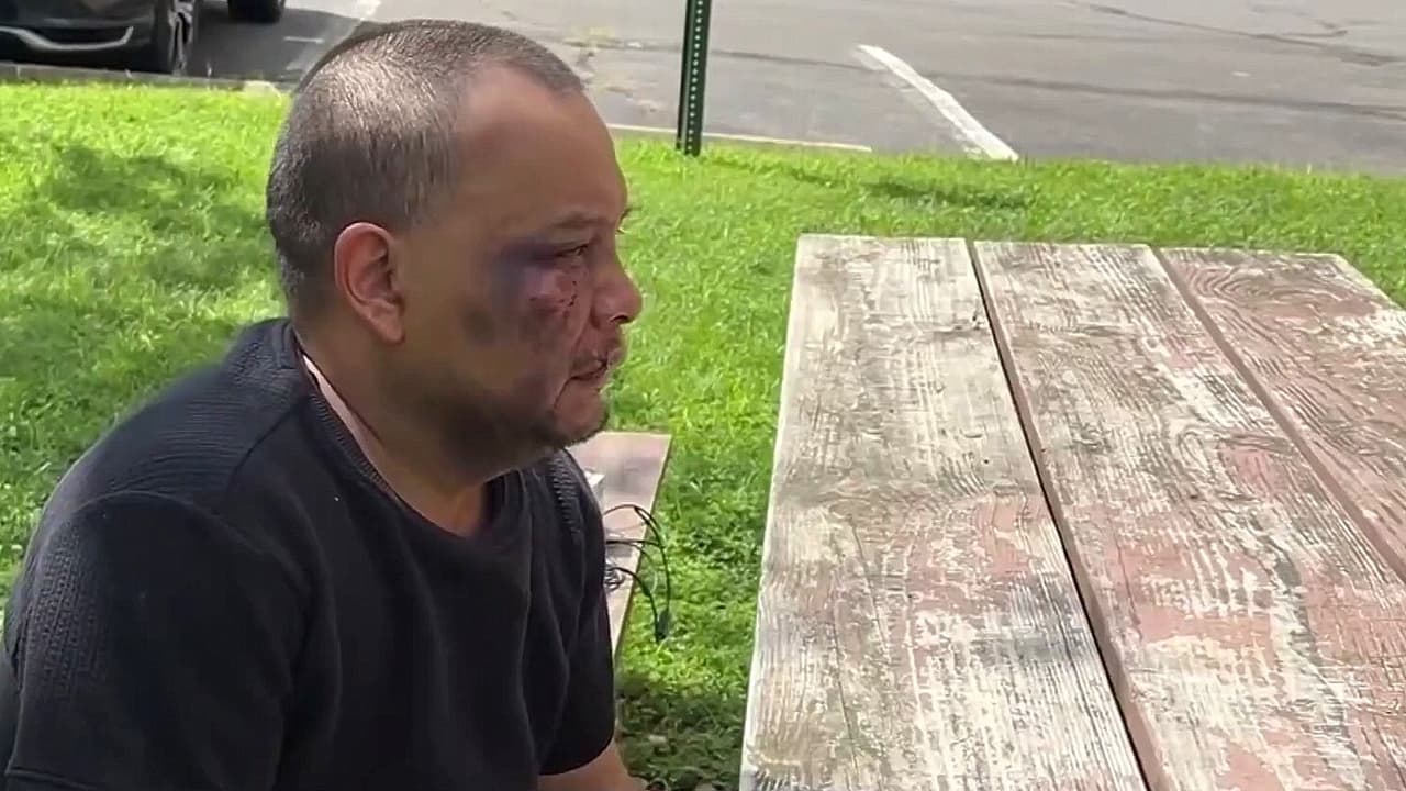 Retiran grillete a José Mejía, inmigrante golpeado por ICE, para someterlo a resonancia magnética