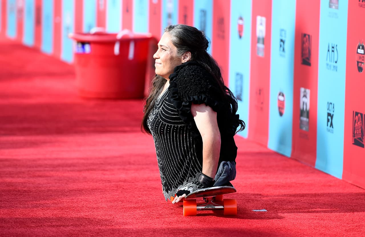 Rose Siggins falleció en Denver, tenía 43 años y era una de las contadas actrices que sí tenía una malformación física dentro de la serie "American Horror Story: Freak Show". Descanse en paz.