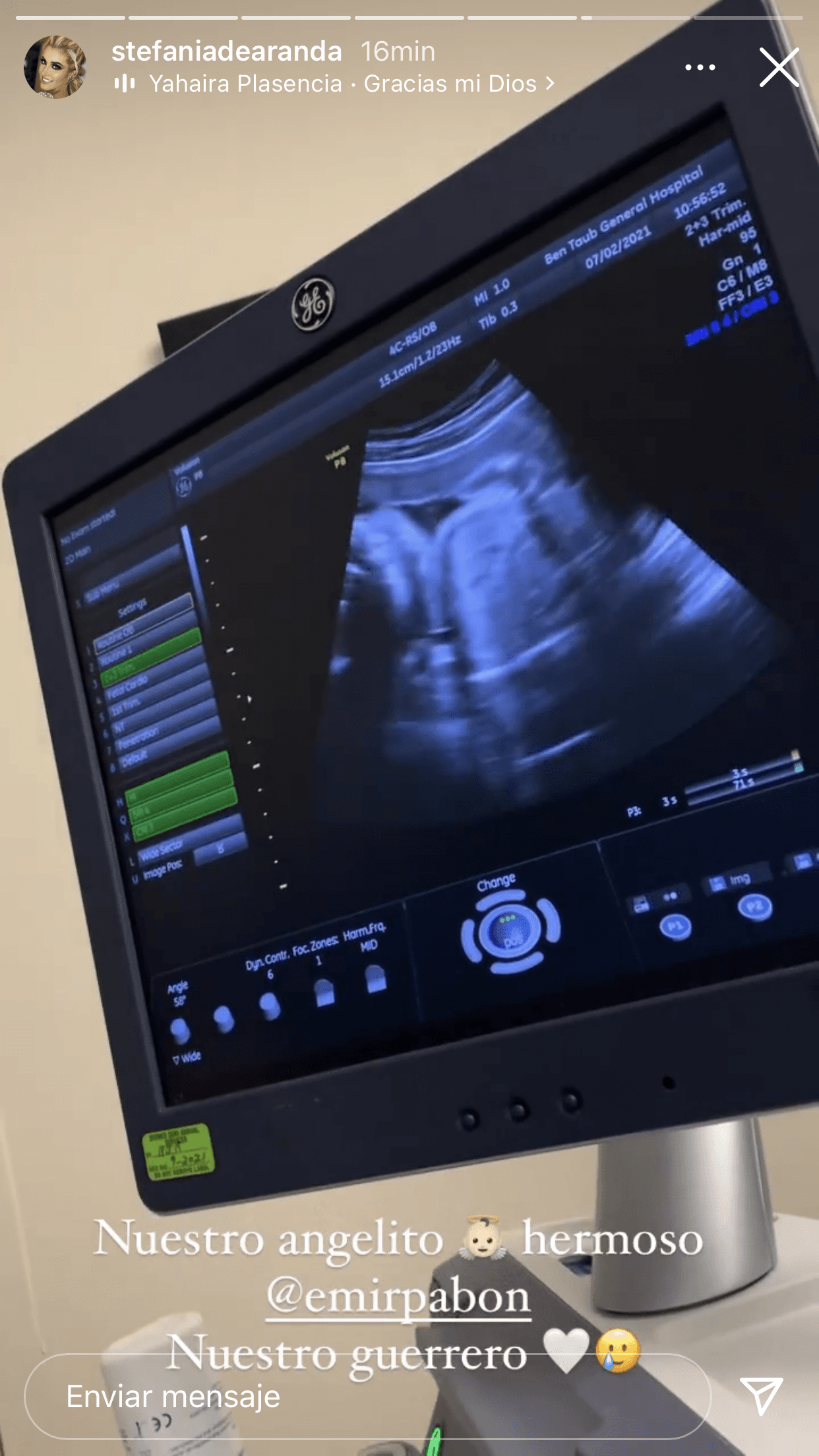 Pero también, la pareja mostró por primera ocasión a su bebé tras el accidente. Lo hicieron minetras a ella se le realizó un ultrasonido para monitorear al niño, a quienes ya describen como "un guerrero" ante lo sucedido y por aferrarse a la vida. 
<br>