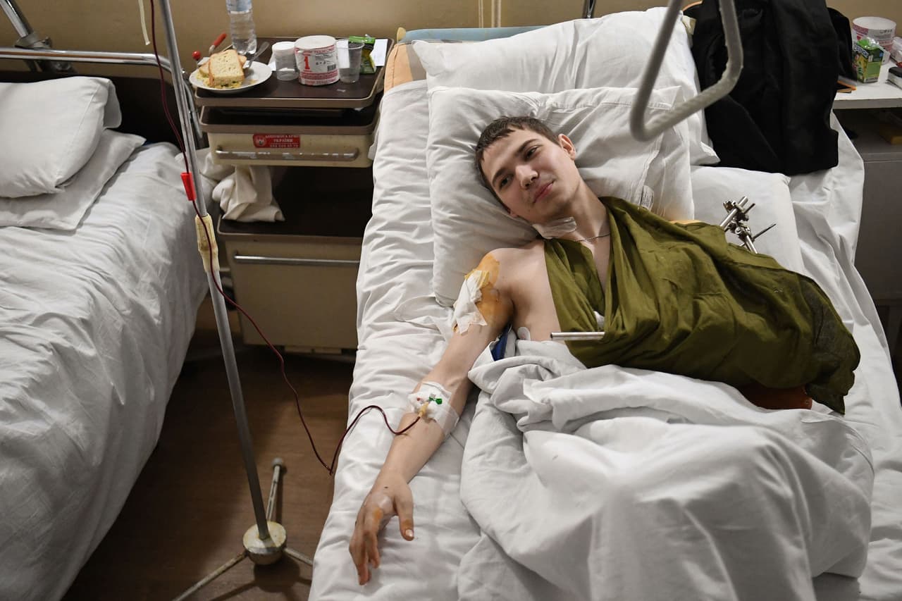 Yevhen, un soldado ucraniano de 19 años mientras es atendido en un hospital de Lviv, el 1 de marzo de 2022. Resultó herido por herido por una mina en la región de Luhansk, muy cerca de la frontera con Rusia al este de Ucrania.