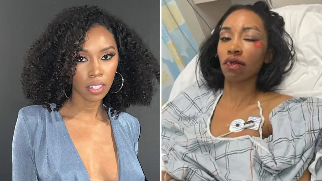 Actriz de Marvel brutalmente atropellada "no es capaz de caminar": claman por ayuda para ella