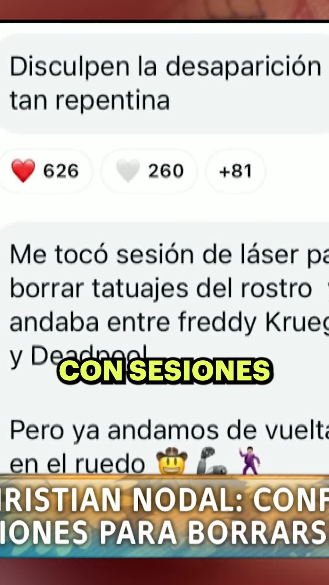 Nodal sorprende a los conductores de Hoy al confirmar que se retira sus tatuajes