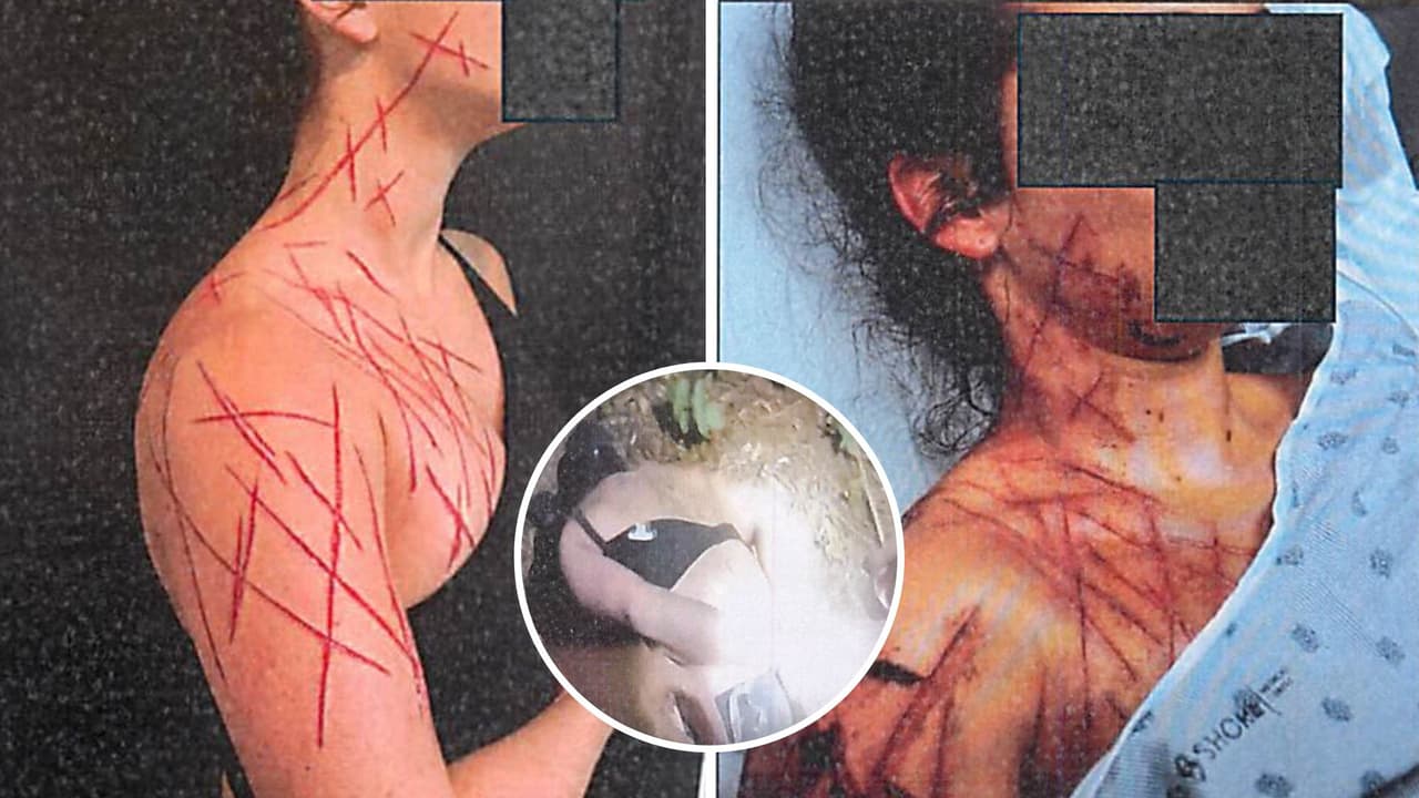 Acusan a empleada federal de fingir ataque político tras cortarse la piel en Nueva Jersey