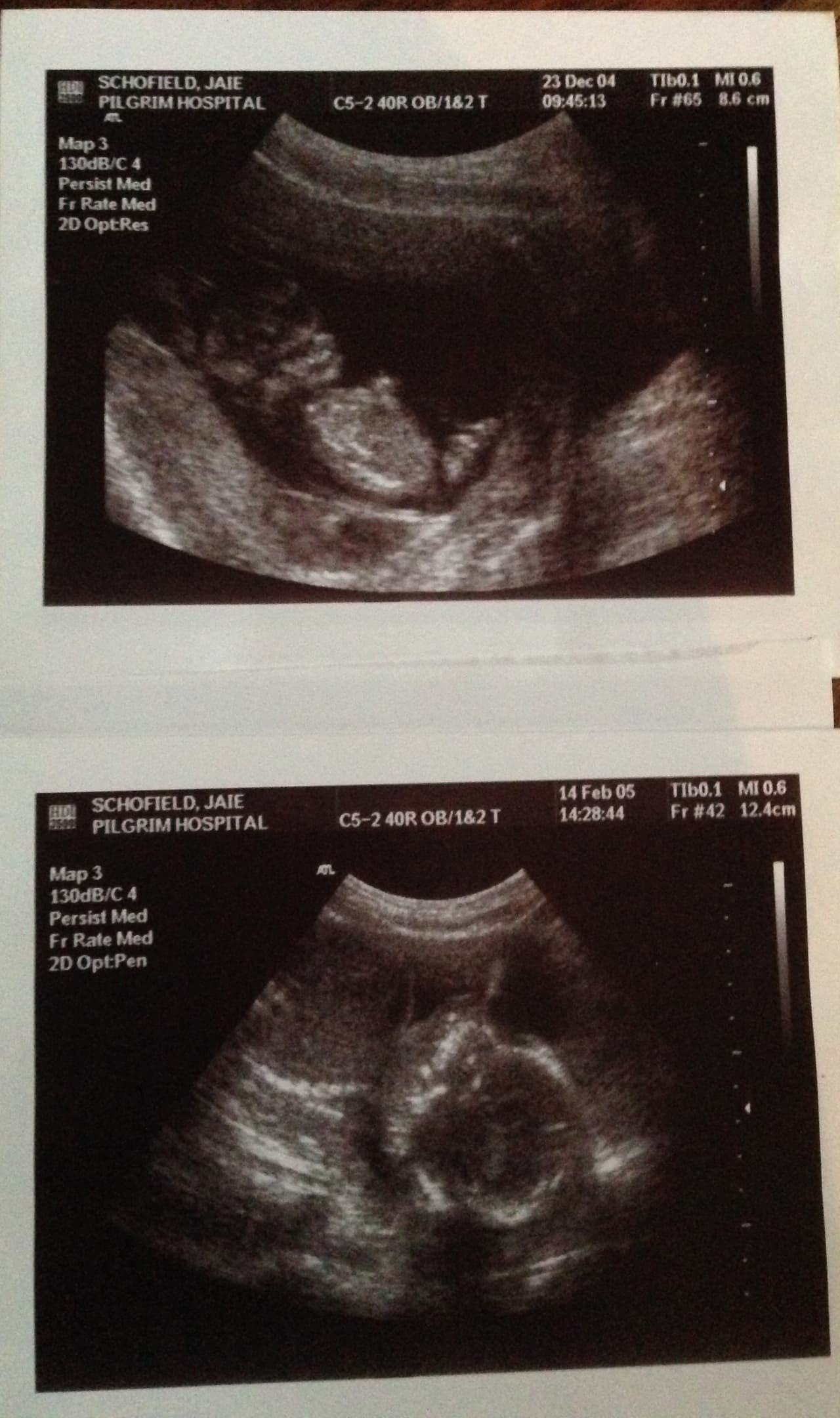 Jaie Schofield finalmente tuvo un embarazo adecuado, sin preocupaciones.