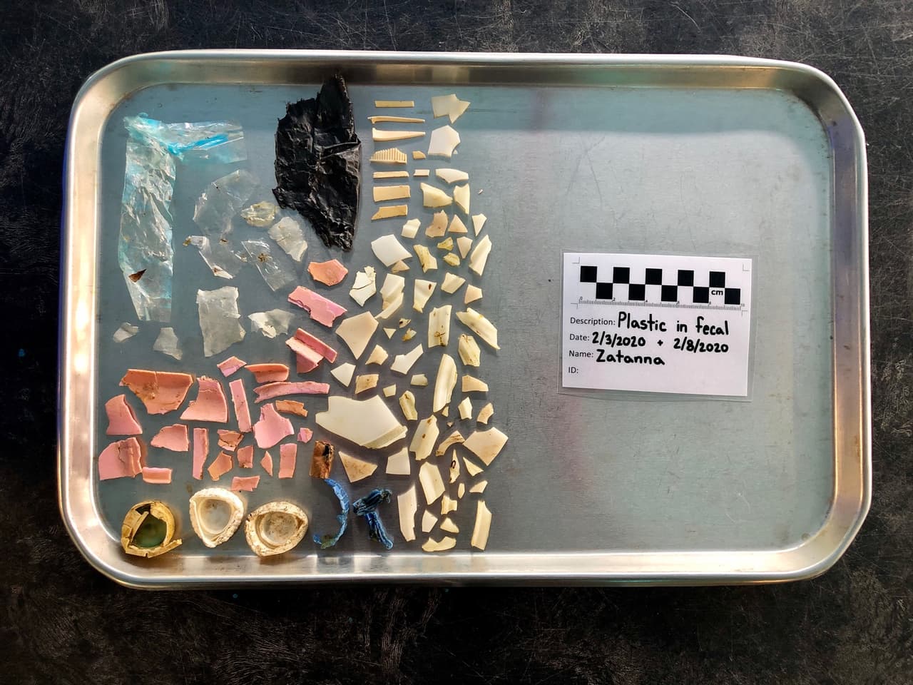 En el curso de una semana, la tortuga, bautizada como Zatanna, descargó más de 100 piezas de plástico. Entre los objetos había tapas de botellas, pedazos de cubiertos, basura y bolsas Zip-Lock y fragmentos grandes de plástico.
<br>