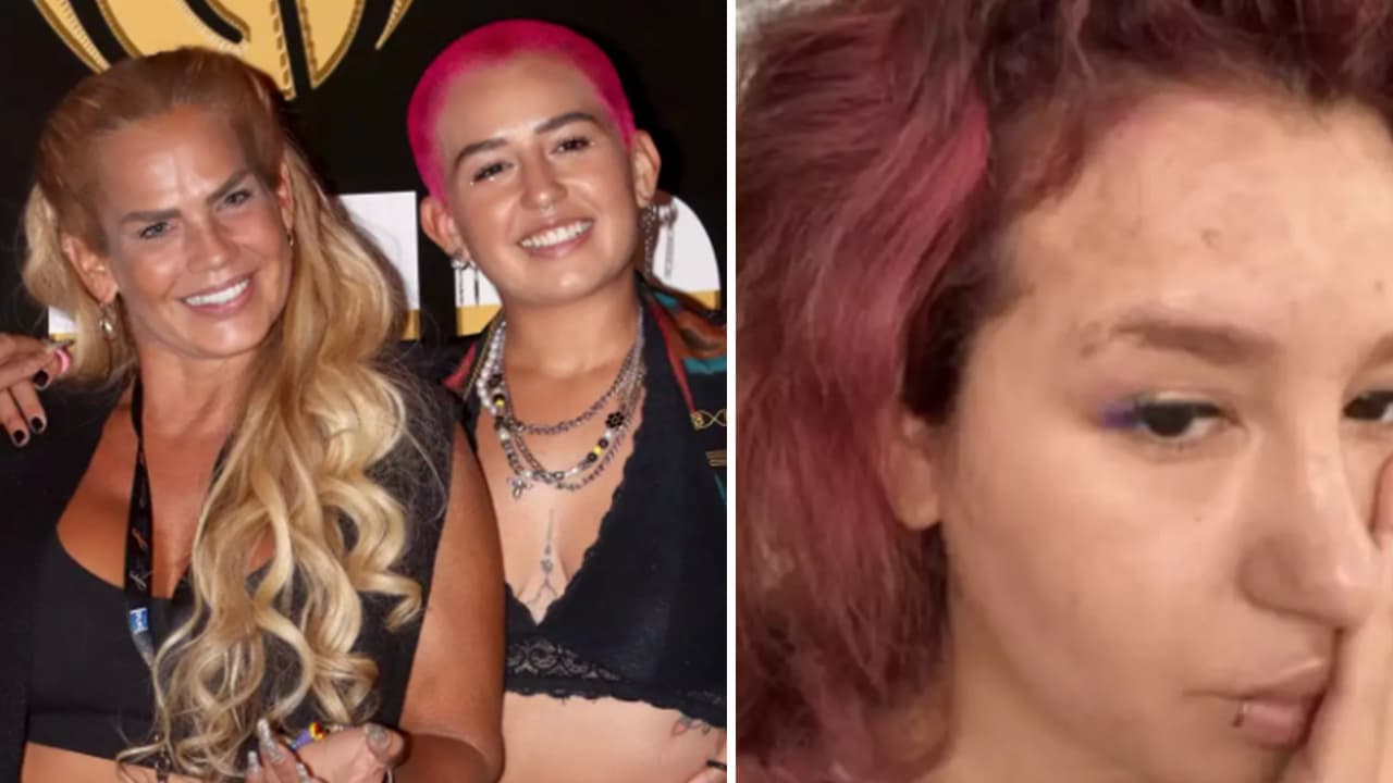 Romina, hija de Niurka, revela cómo está luchando contra la enfermedad que afectó su cara