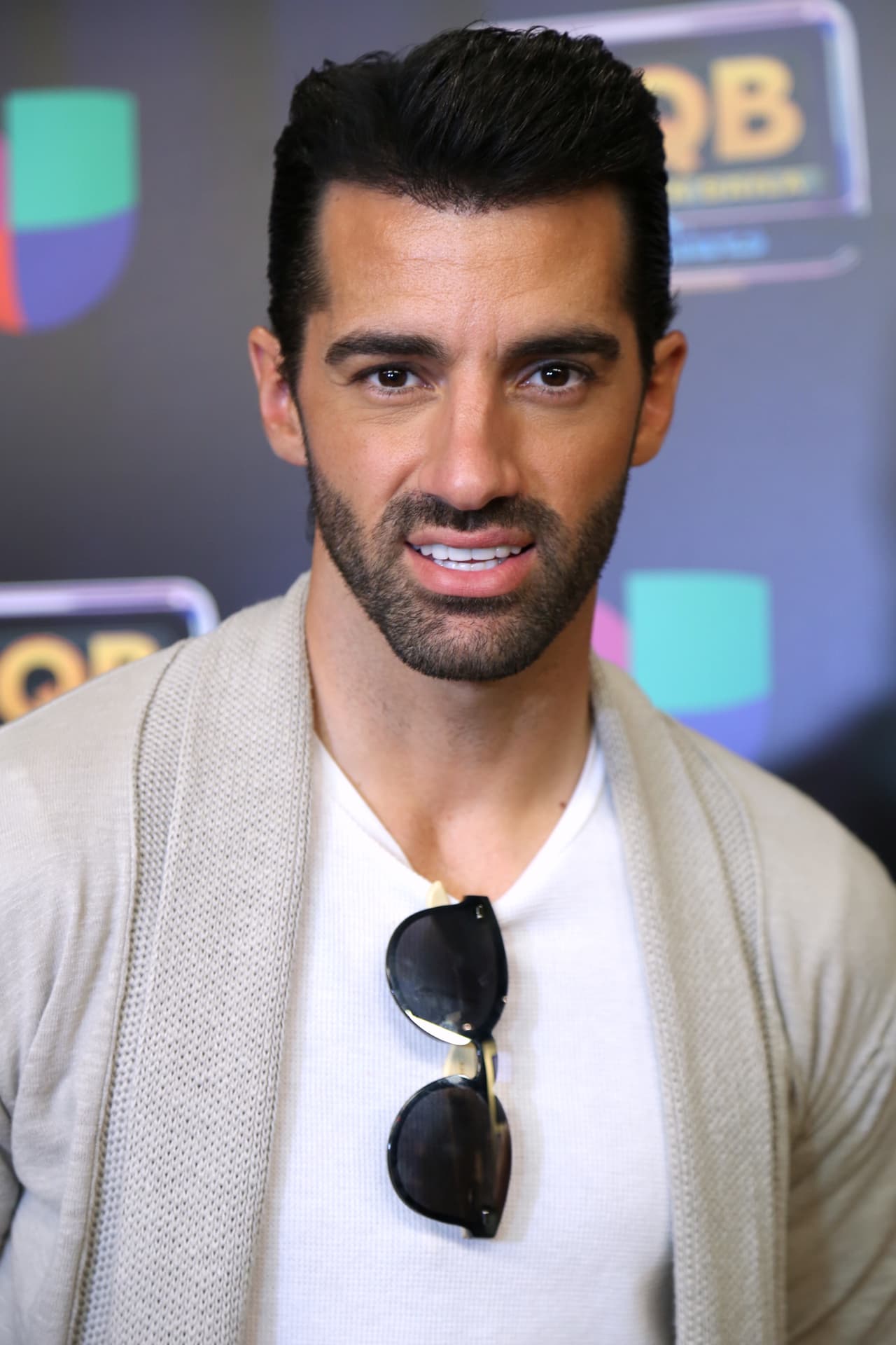 La pérdida de cabello es un problema común entre los hombres y otro famoso que buscó la manera de impedirlo fue
<b>Toni Costa</b>.