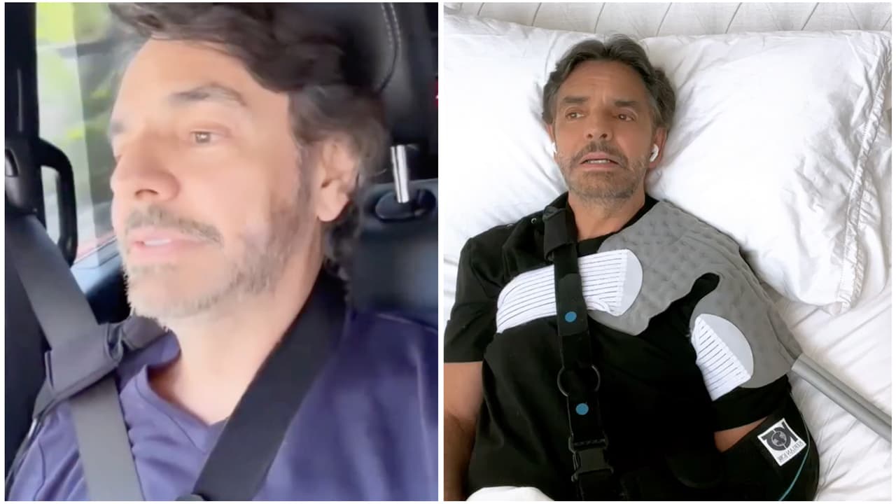 "Estoy harto de sentir dolor": Eugenio Derbez habla de la "tortura" de su recuperación tras su accidente