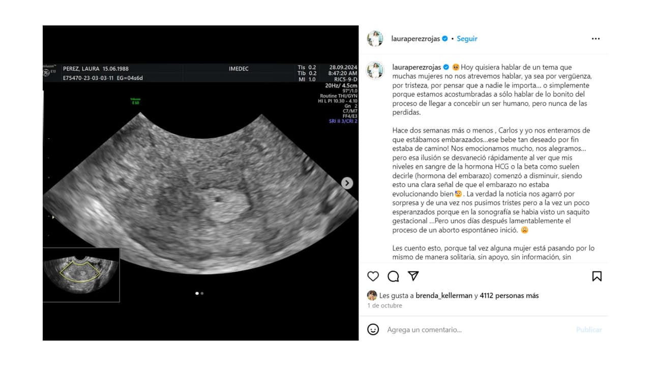 La esposa de Carlos de la Mota anunció la perdida de su bebé con un mensaje en Instagram.