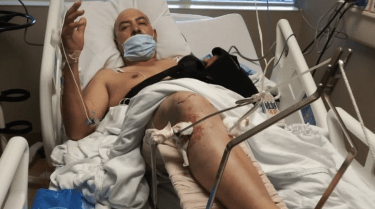 Durante el mes de octubre,
<b><a href="https://www.univision.com/local/fresno-kftv/es-una-locura-lo-que-viven-vendedores-ambulantes-cinco-ataques-en-california-que-asi-lo-revelan">dos vendedores ambulantes sufrieron fuertes golpizas en el sur de California, </a></b>mientras que en Fresno, el 18 de octubre,
<b><a href="https://www.univision.com/local/fresno-kftv/balean-a-vendedor-de-elote-de-fresno-y-sus-familiares-no-saben-si-podra-caminar-nuevamente">un vendedor de elotes fue baleado en su pierna</a></b> sin saber si volvería a caminar.